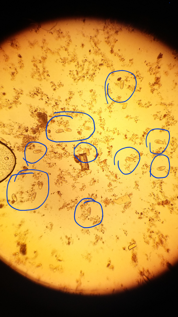 a giardia parazita nagysága papillomatosis icd 10